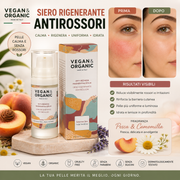 Vegan & Organic Siero Rigenerante Antirossori 30ml – Siero Viso Lenitivo Pelle Sensibile